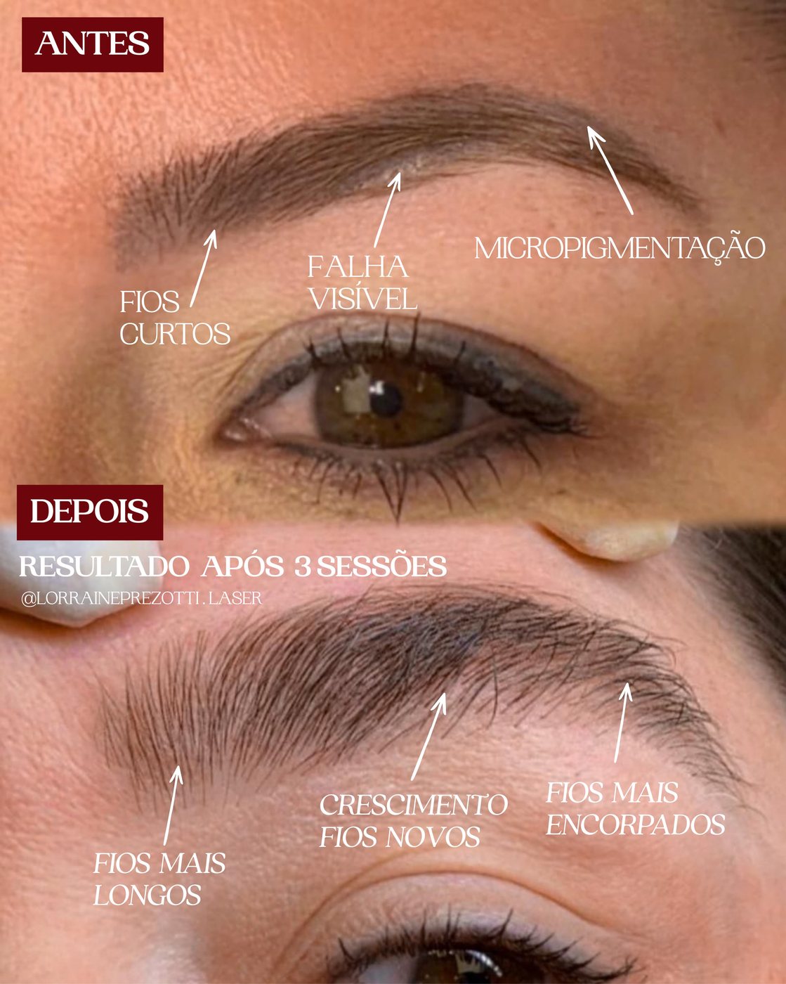 ExoBrows — antes e depois